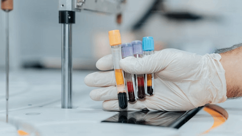 INmune Bio Announces Submission of Phase 2 MINDFuL Trial Results in Alzheimer’s Disease to npj Dementia, a Nature Portfolio Journal