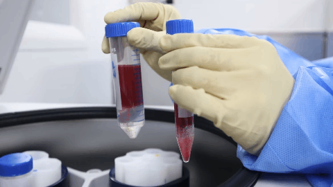 Scancell announces FDA clearance of IND application for global Phase 3 trial of iSCIB1+ in advanced melanoma