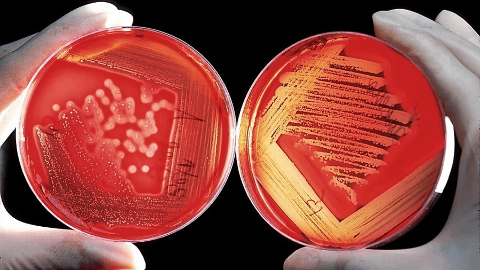 SCYNEXIS to Present Preclinical Data on Second Generation IV/Oral Fungerp SCY-247 at the European Society of Clinical Microbiology and Infectious Diseases (ESCMID)