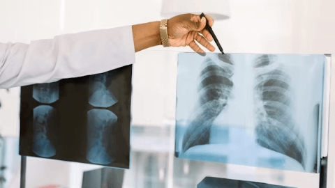 Nuvectis Pharma to Host a Virtual Key Opinion Leader Meeting to Discuss the NXP900 Phase 1b Program in Advanced Solid Tumors, Including the Combination with Osimertinib in NSCLC