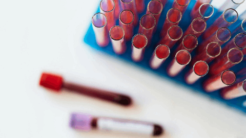 Algernon Pharmaceuticals Receives Notice of Allowance from European Patent Office for Repirinast for Kidney Disease
