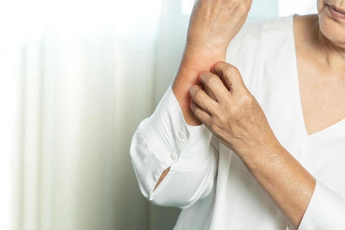 The Math Behind Eczema Flare-Ups May Finally Add Up